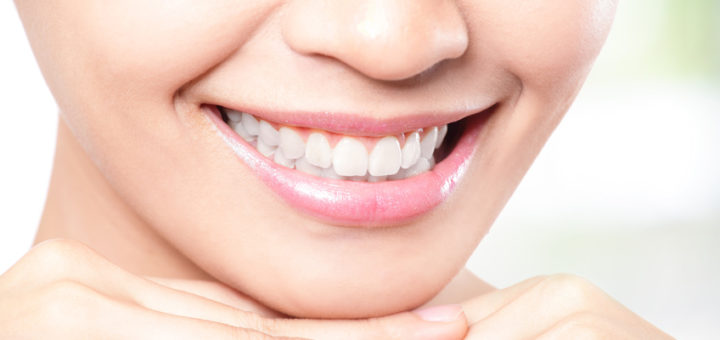 Ästhetische Zahnrekonstruktionen